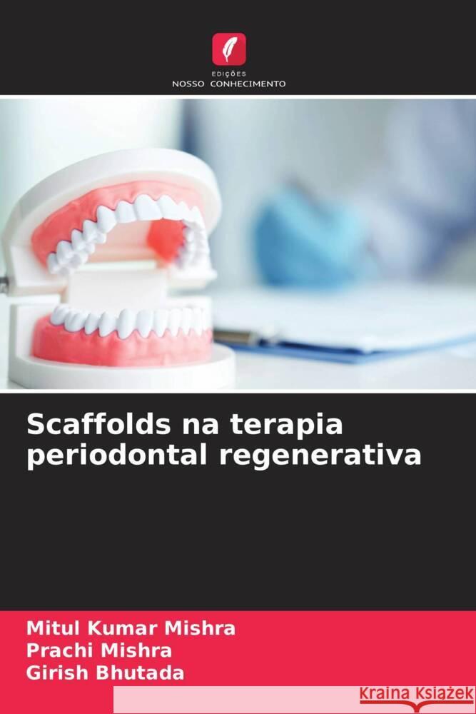 Scaffolds na terapia periodontal regenerativa Mitul Kumar Mishra Prachi Mishra Girish Bhutada 9786206925644