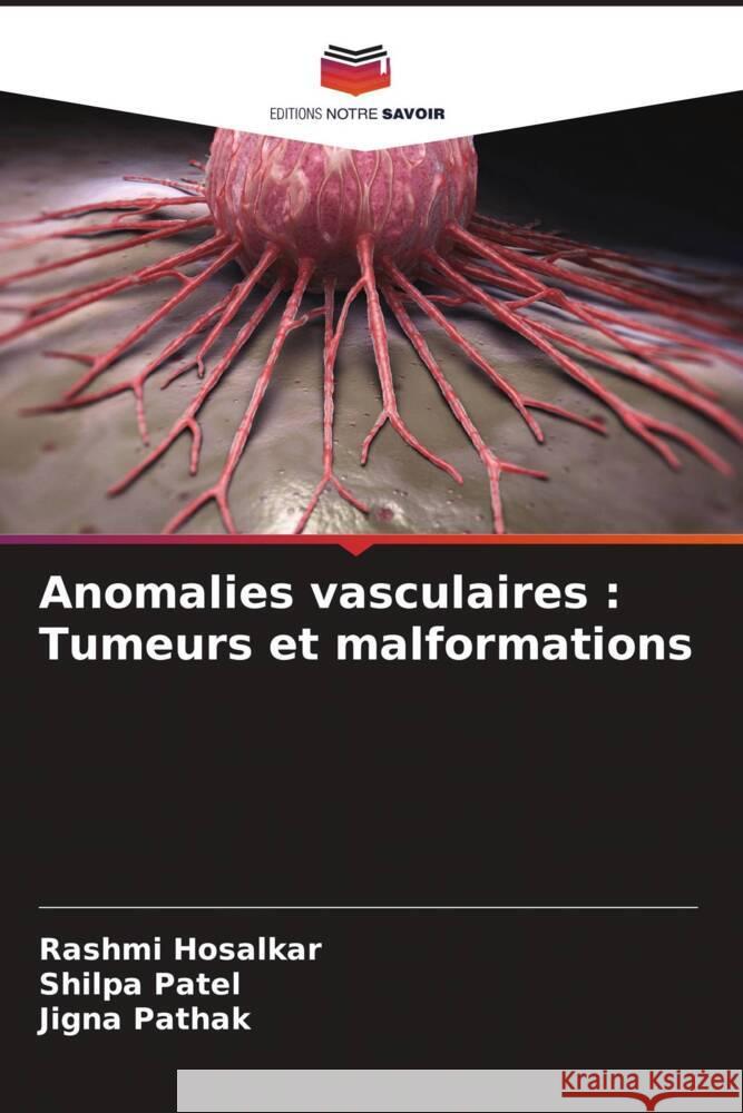 Anomalies vasculaires: Tumeurs et malformations Rashmi Hosalkar Shilpa Patel Jigna Pathak 9786206934646