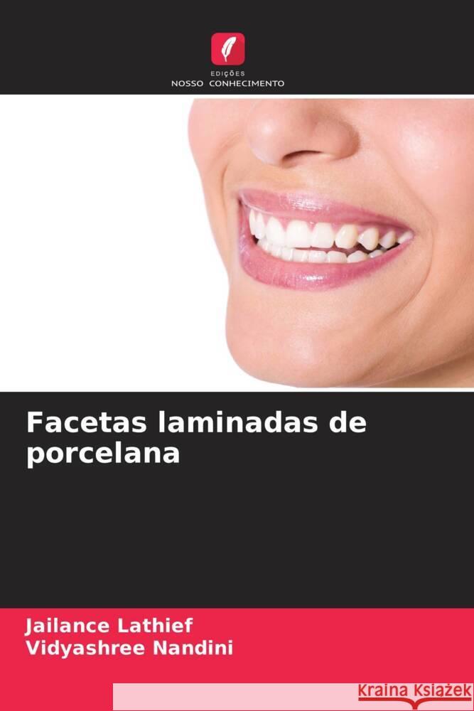 Facetas laminadas de porcelana Jailance Lathief Vidyashree Nandini 9786206938255