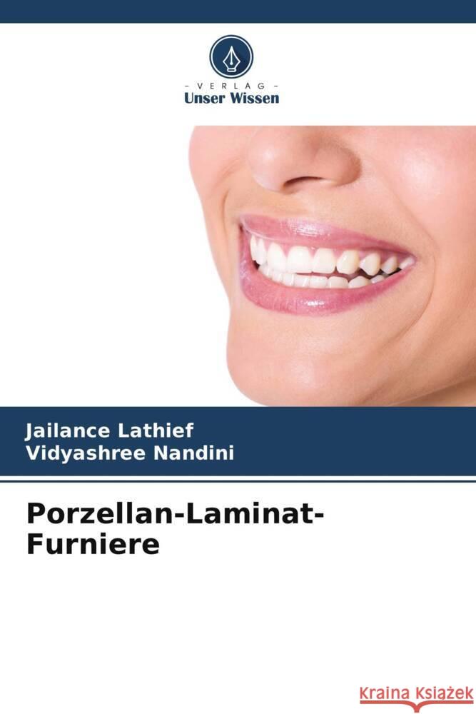 Porzellan-Laminat-Furniere Jailance Lathief Vidyashree Nandini 9786206938262