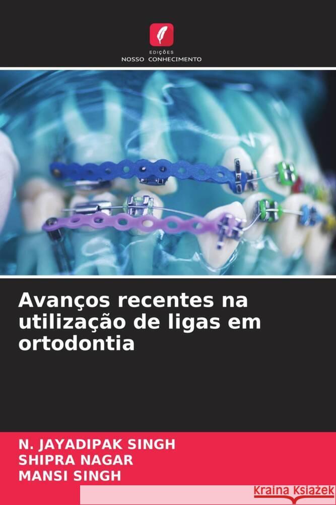 Avan?os recentes na utiliza??o de ligas em ortodontia N. Jayadipak Singh Shipra Nagar Mansi Singh 9786206938835 Edicoes Nosso Conhecimento