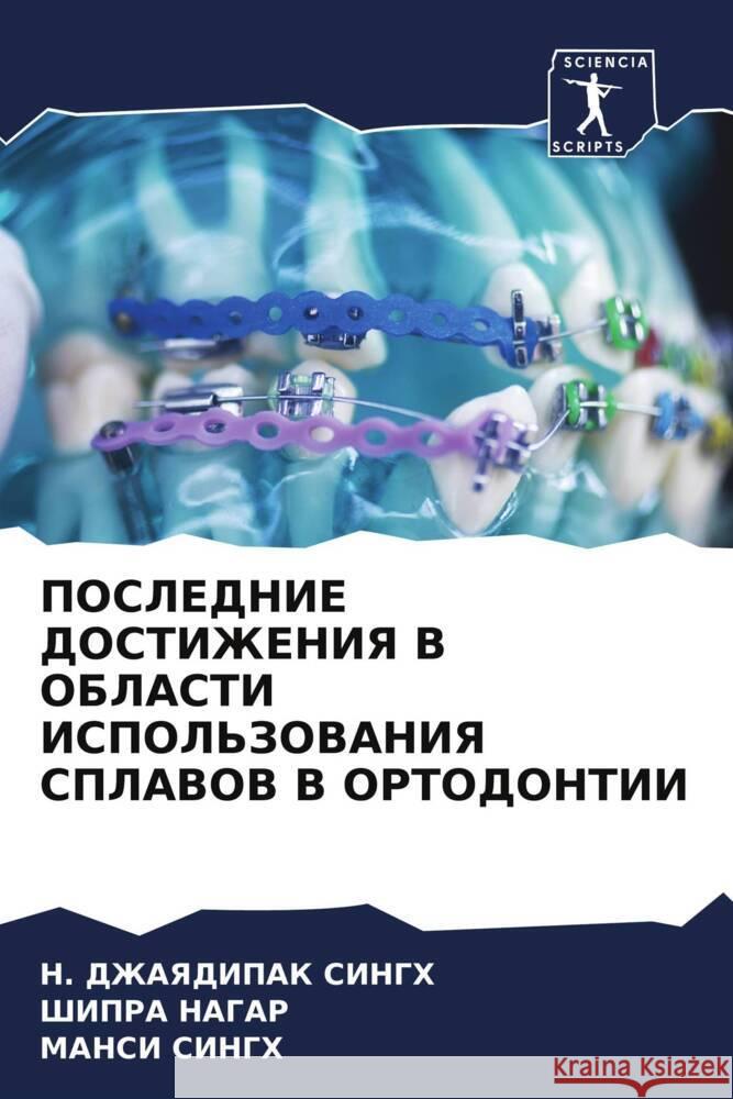 POSLEDNIE DOSTIZhENIYa V OBLASTI ISPOL'ZOVANIYa SPLAVOV V ORTODONTII SINGH, N. DZhAYaDIPAK, Nagar, Shipra, Singh, Mansi 9786206938842