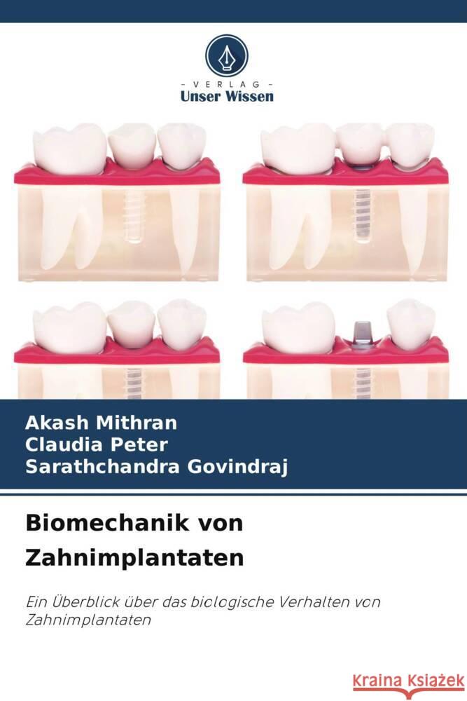 Biomechanik von Zahnimplantaten Mithran, Akash, Peter, Claudia, GOVINDRAJ, Sarathchandra 9786206943808