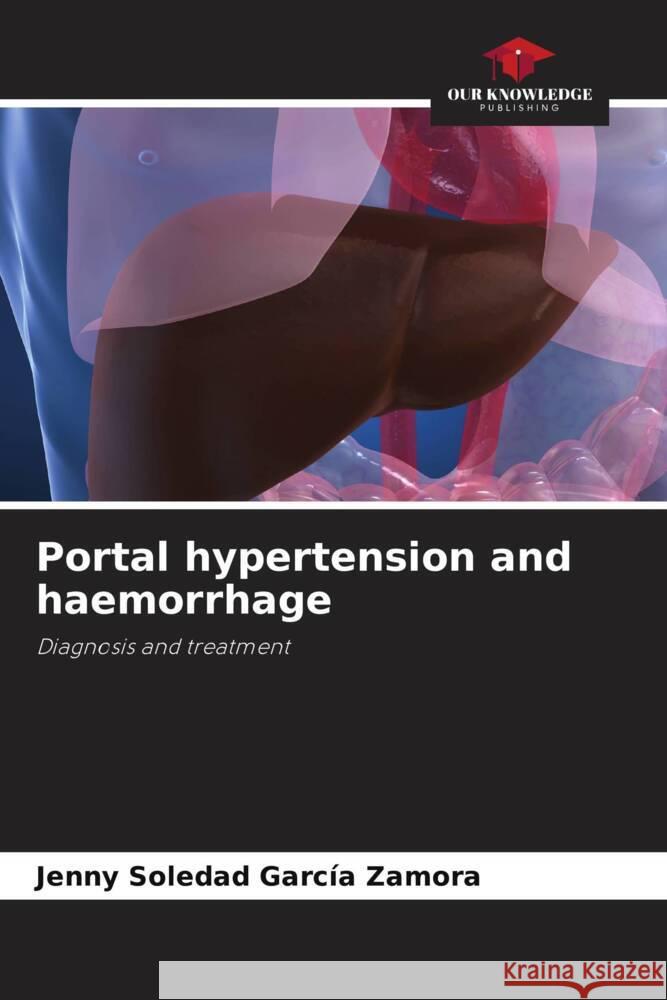 Portal hypertension and haemorrhage García Zamora, Jenny Soledad 9786206946175