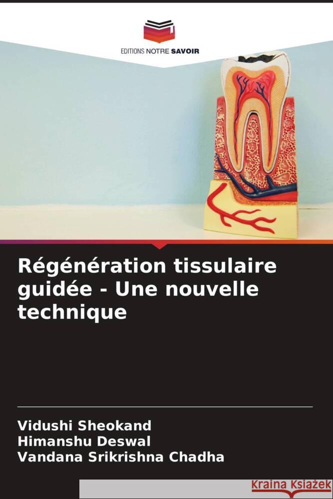 R?g?n?ration tissulaire guid?e - Une nouvelle technique Vidushi Sheokand Himanshu Deswal Vandana Srikrishna Chadha 9786206947936