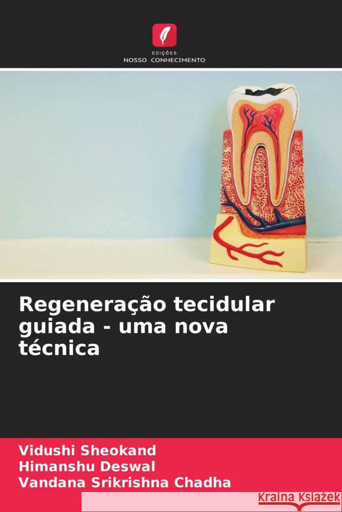 Regenera??o tecidular guiada - uma nova t?cnica Vidushi Sheokand Himanshu Deswal Vandana Srikrishna Chadha 9786206947950