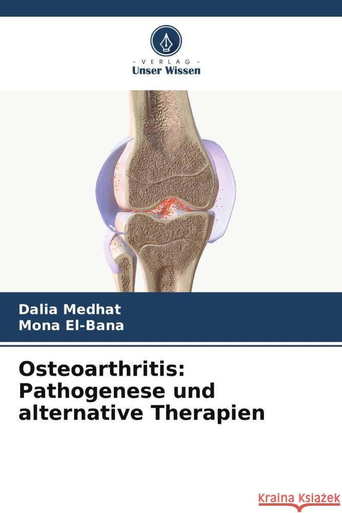 Osteoarthritis: Pathogenese und alternative Therapien Dalia Medhat Mona El-Bana 9786206950370