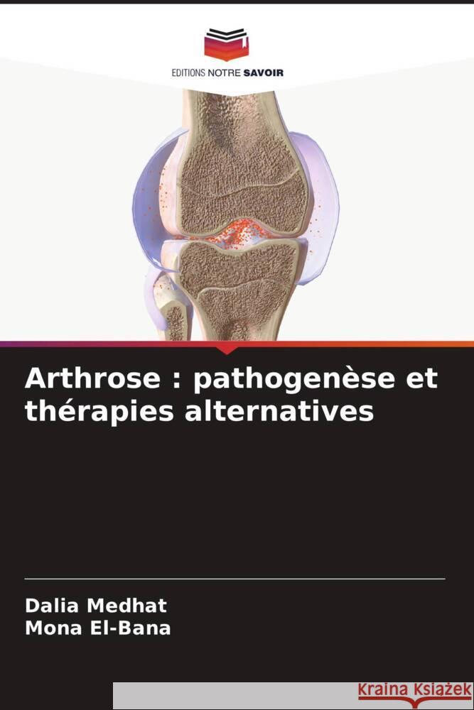 Arthrose: pathogen?se et th?rapies alternatives Dalia Medhat Mona El-Bana 9786206950394