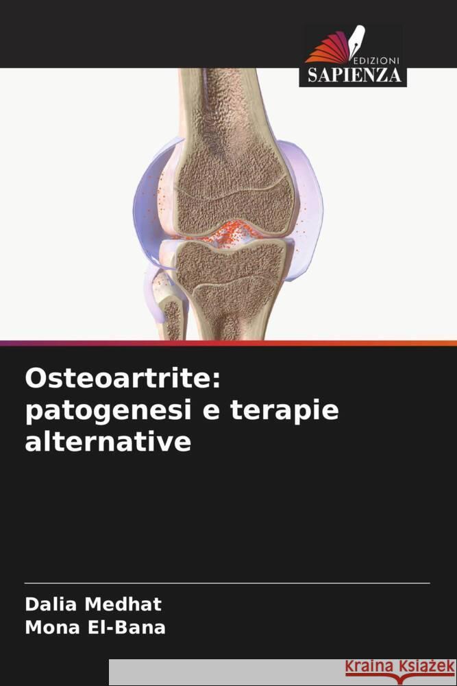 Osteoartrite: patogenesi e terapie alternative Dalia Medhat Mona El-Bana 9786206950400