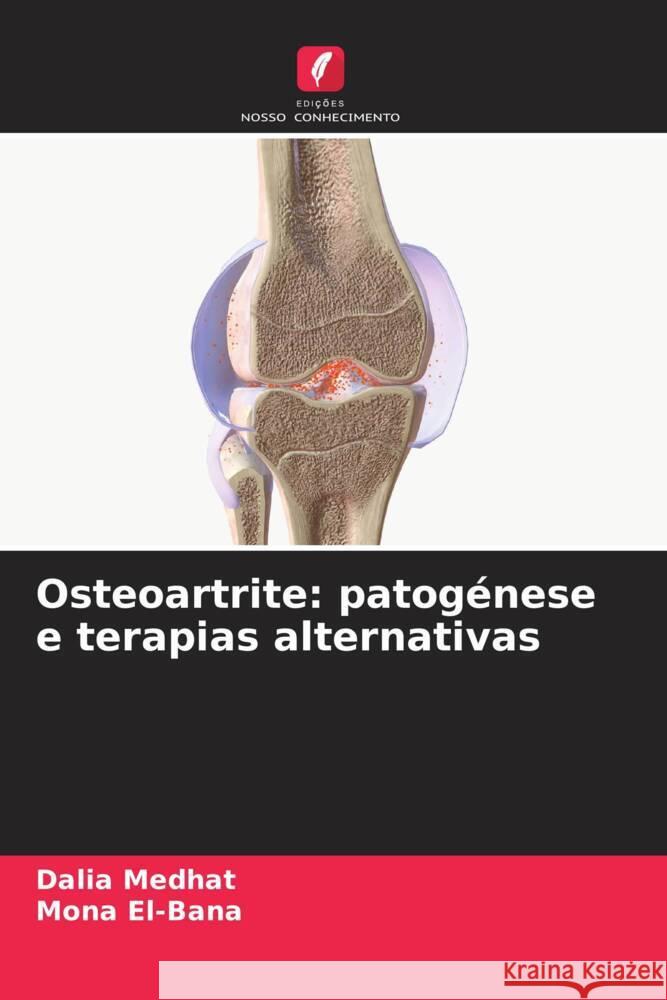 Osteoartrite: patog?nese e terapias alternativas Dalia Medhat Mona El-Bana 9786206950417