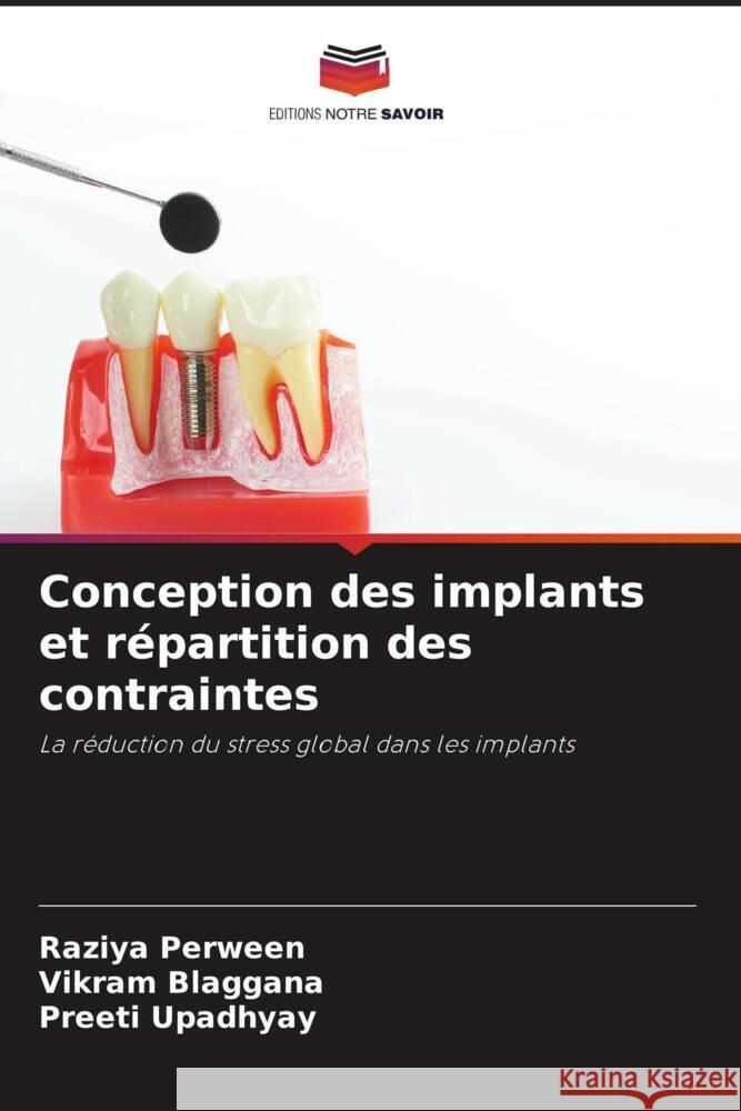 Conception des implants et r?partition des contraintes Raziya Perween Vikram Blaggana Preeti Upadhyay 9786206951117