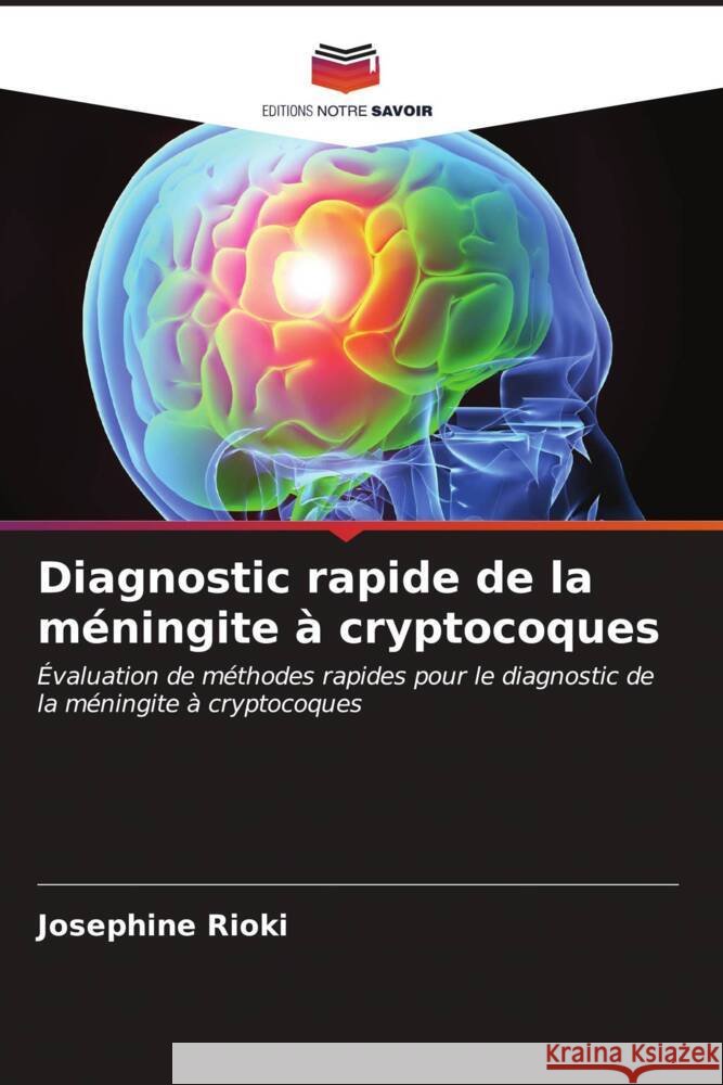 Diagnostic rapide de la m?ningite ? cryptocoques Josephine Rioki 9786206967019