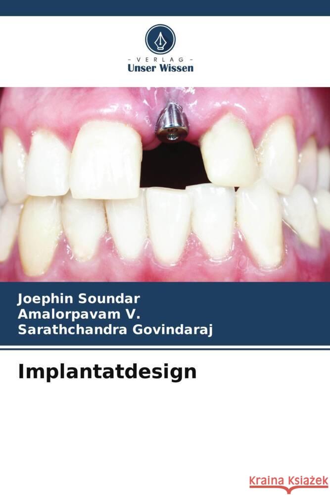 Implantatdesign Joephin Soundar Amalorpavam V Sarathchandra Govindaraj 9786206974383