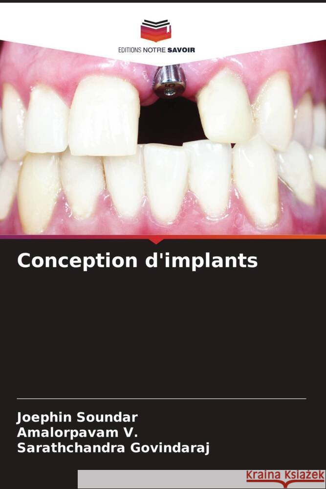 Conception d'implants Joephin Soundar Amalorpavam V Sarathchandra Govindaraj 9786206974406 Editions Notre Savoir
