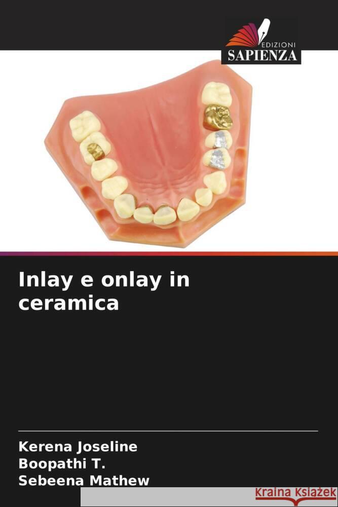 Inlay e onlay in ceramica Kerena Joseline Boopathi T Sebeena Mathew 9786206974864 Edizioni Sapienza