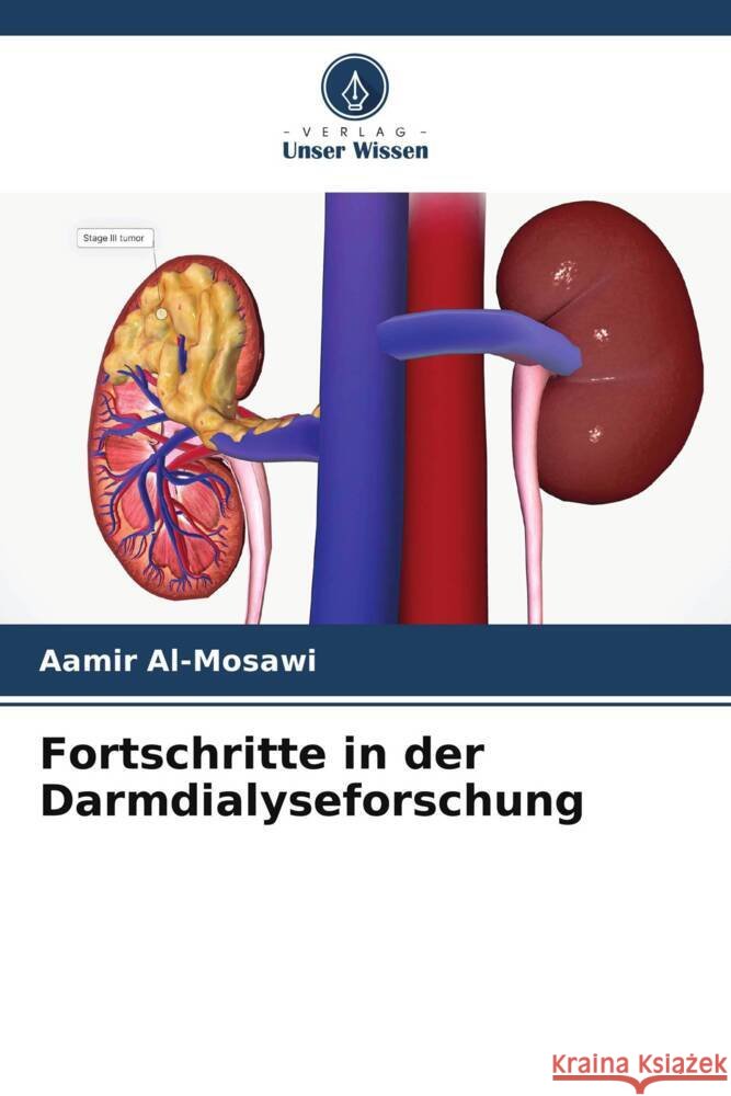 Fortschritte in der Darmdialyseforschung Aamir Al-Mosawi 9786206983484 Verlag Unser Wissen