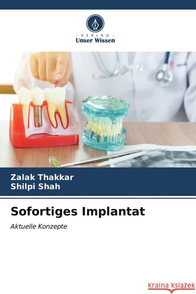 Sofortiges Implantat Zalak Thakkar Shilpi Shah 9786206987994