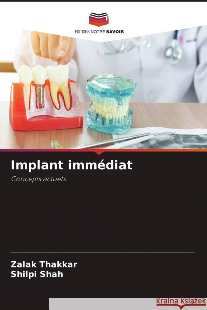 Implant imm?diat Zalak Thakkar Shilpi Shah 9786206988014