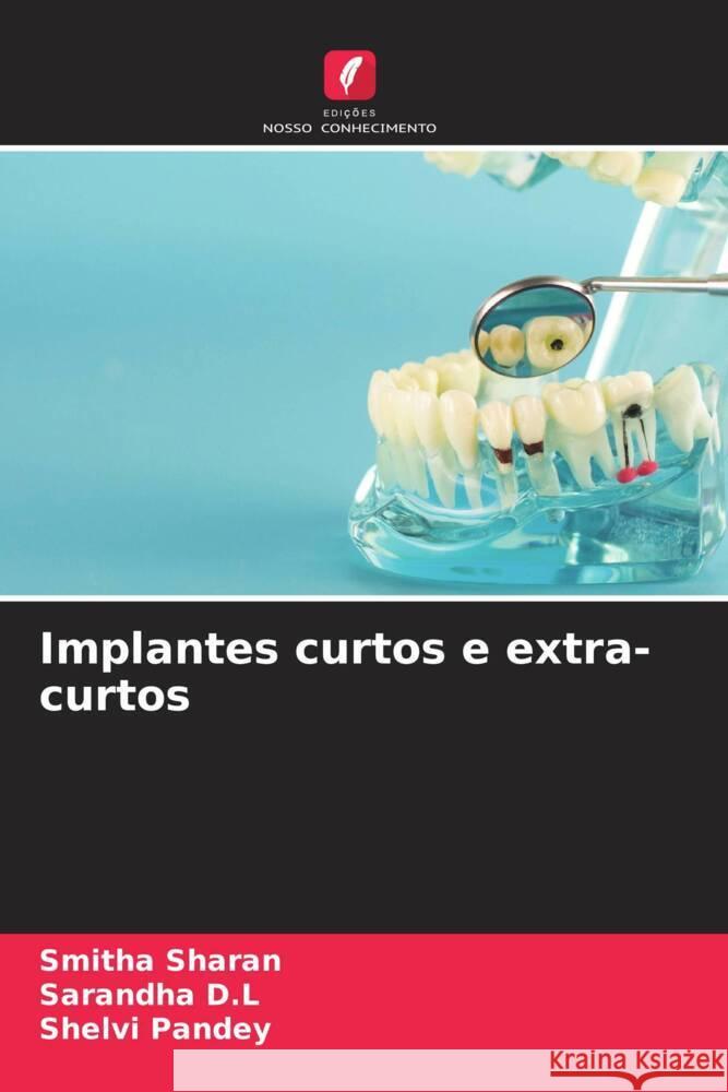 Implantes curtos e extra-curtos Smitha Sharan Sarandha D Shelvi Pandey 9786206993285