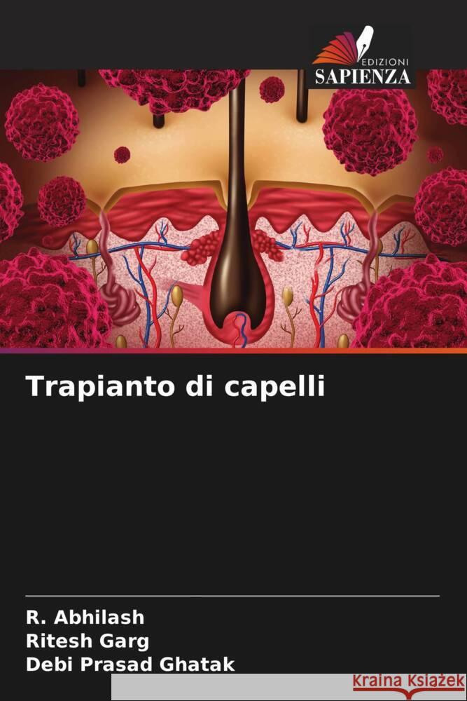 Trapianto di capelli R. Abhilash Ritesh Garg Debi Prasad Ghatak 9786206994923 Edizioni Sapienza