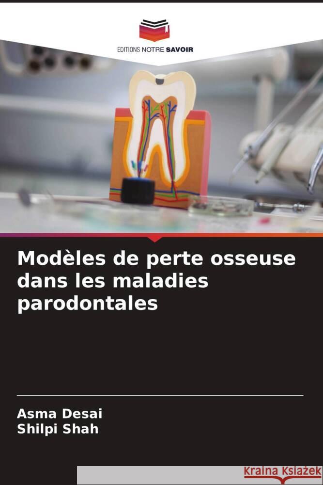 Mod?les de perte osseuse dans les maladies parodontales Asma Desai Shilpi Shah 9786206999713