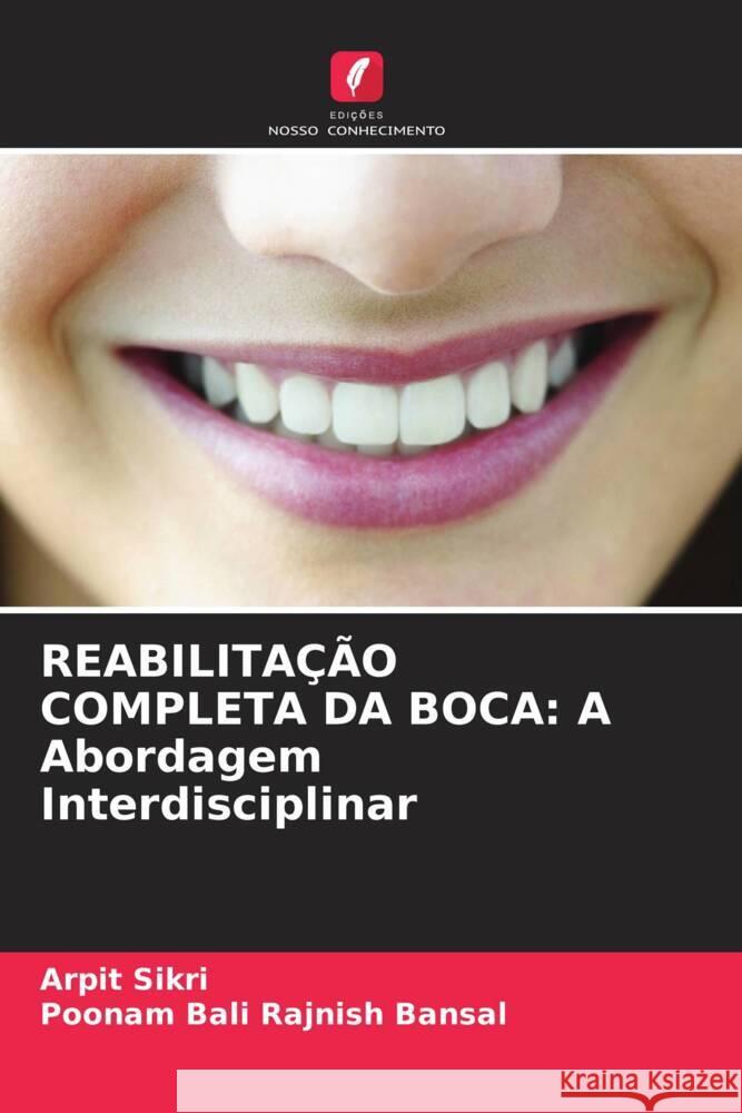 Reabilita??o Completa Da Boca: A Abordagem Interdisciplinar Arpit Sikri Poonam Bali Rajnis 9786207002115