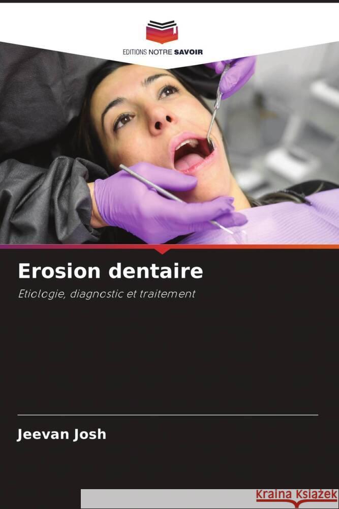 Erosion dentaire Josh, Jeevan 9786207009626