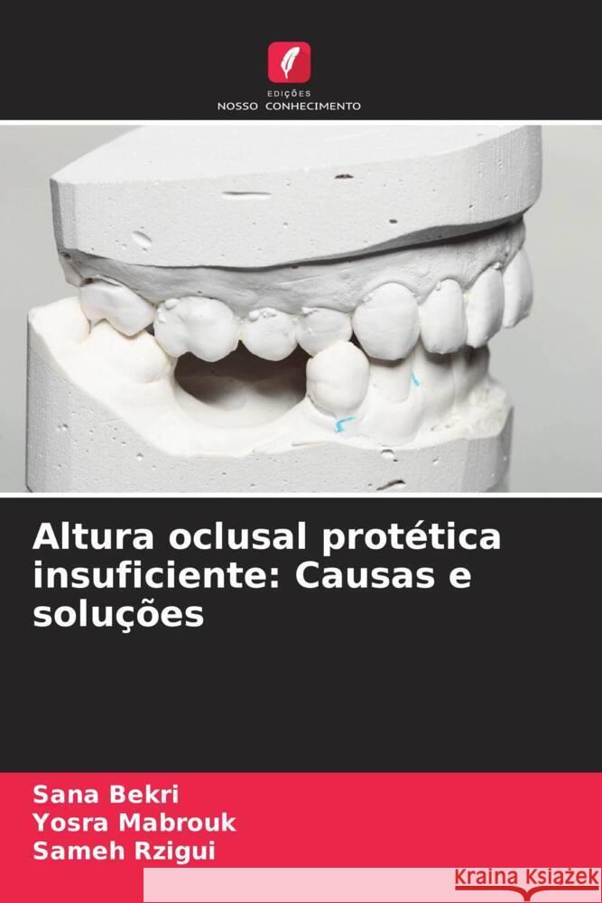 Altura oclusal prot?tica insuficiente: Causas e solu??es Sana Bekri Yosra Mabrouk Sameh Rzigui 9786207010387