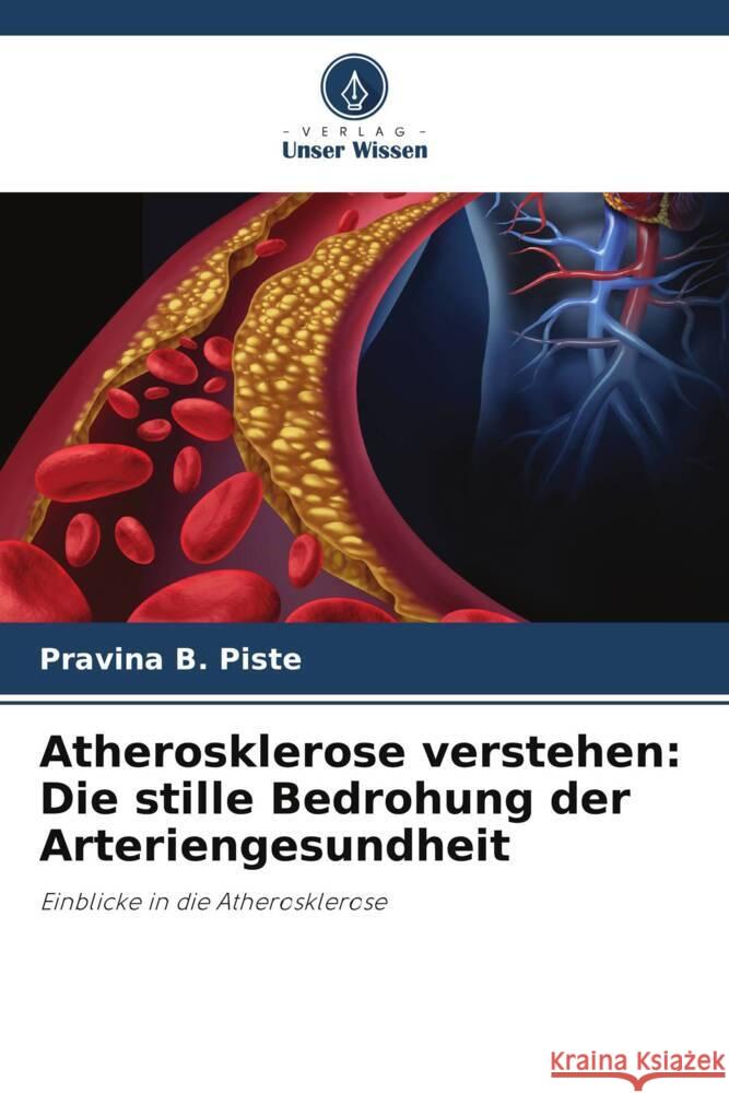 Atherosklerose verstehen: Die stille Bedrohung der Arteriengesundheit Pravina B. Piste 9786207012756