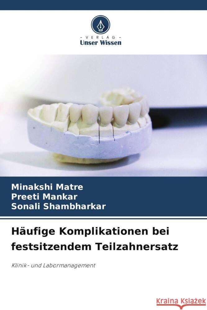 H?ufige Komplikationen bei festsitzendem Teilzahnersatz Minakshi Matre Preeti Mankar Sonali Shambharkar 9786207013647