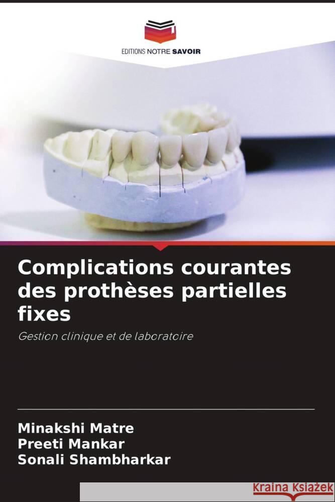 Complications courantes des proth?ses partielles fixes Minakshi Matre Preeti Mankar Sonali Shambharkar 9786207013685