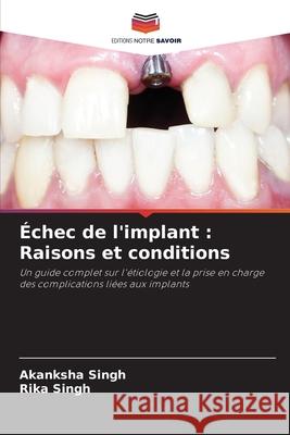 Échec de l'implant : Raisons et conditions Singh, Akanksha, Singh, Rika 9786207027927