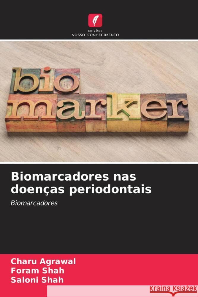 Biomarcadores nas doen?as periodontais Charu Agrawal Foram Shah Saloni Shah 9786207033898