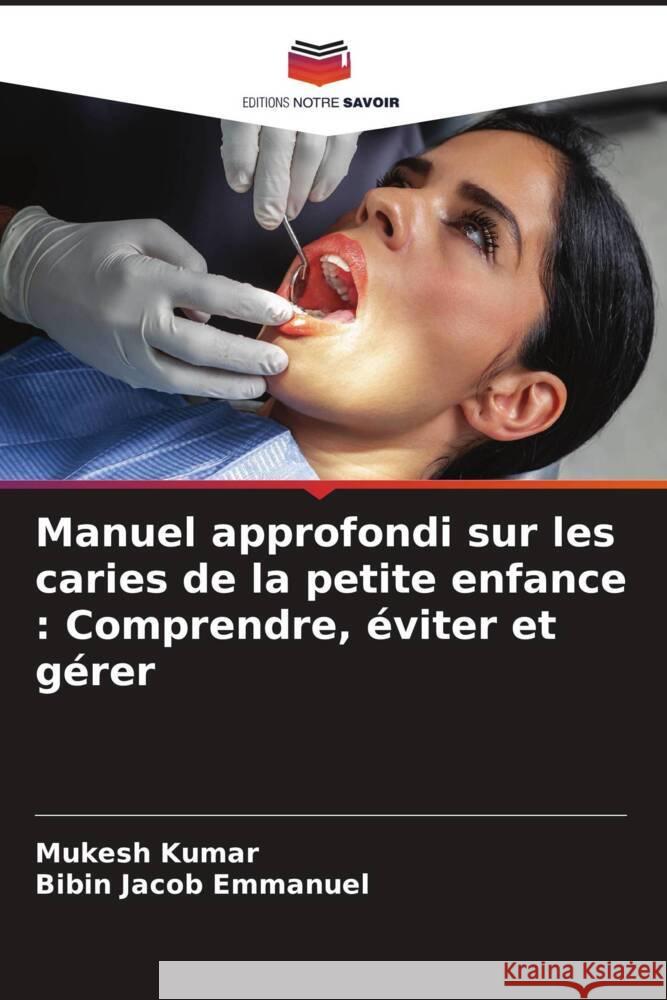 Manuel approfondi sur les caries de la petite enfance: Comprendre, ?viter et g?rer Mukesh Kumar Bibin Jacob Emmanuel 9786207035731 Editions Notre Savoir