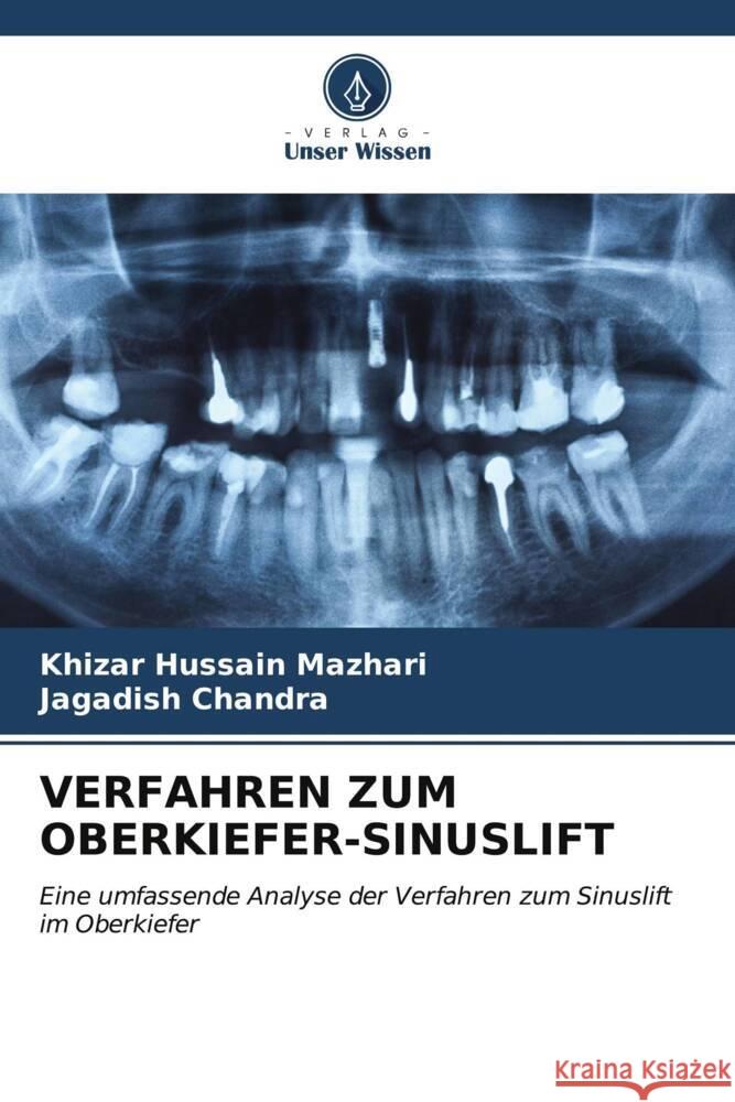 Verfahren Zum Oberkiefer-Sinuslift Khizar Hussain Mazhari Jagadish Chandra 9786207045495