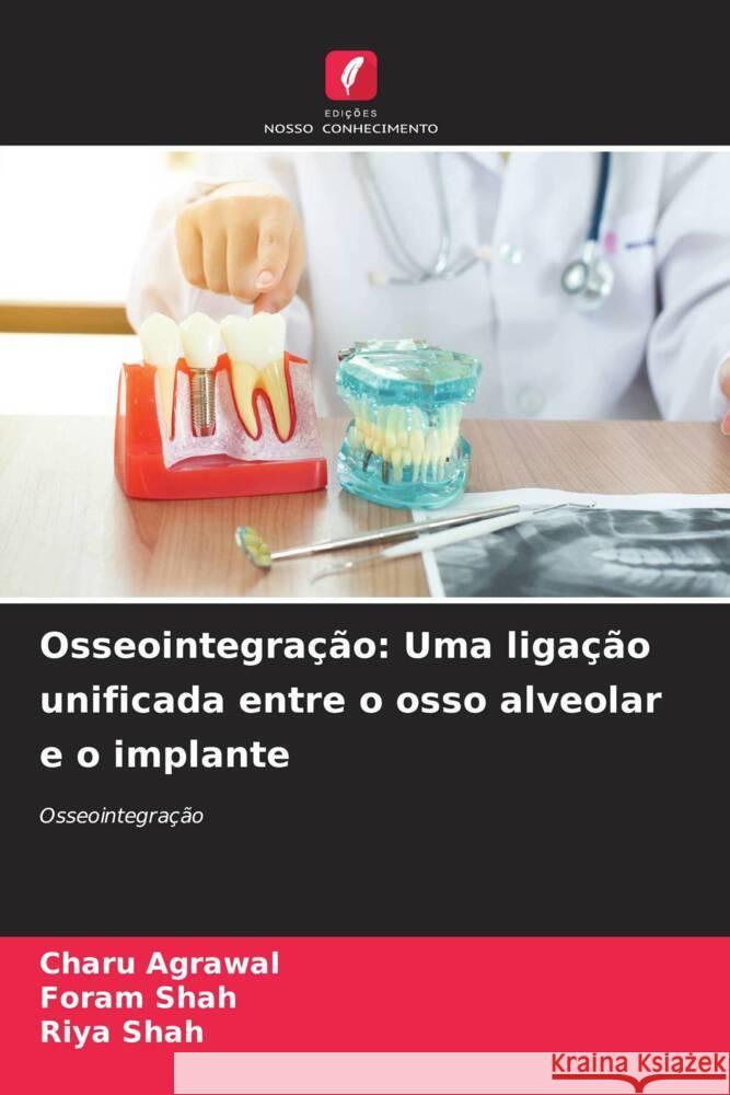 Osseointegra??o: Uma liga??o unificada entre o osso alveolar e o implante Charu Agrawal Foram Shah Riya Shah 9786207048106