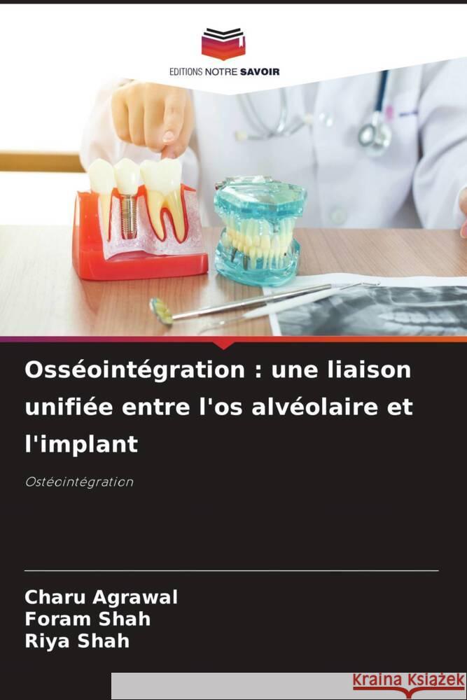 Oss?oint?gration: une liaison unifi?e entre l'os alv?olaire et l'implant Charu Agrawal Foram Shah Riya Shah 9786207048212