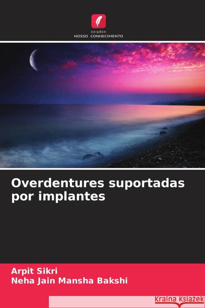 Overdentures suportadas por implantes Sikri, Arpit, Mansha Bakshi, Neha Jain 9786207063253