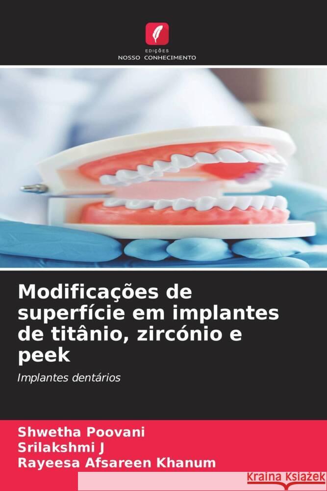 Modificações de superfície em implantes de titânio, zircónio e peek Poovani, Shwetha, J, Srilakshmi, Khanum, Rayeesa Afsareen 9786207083732