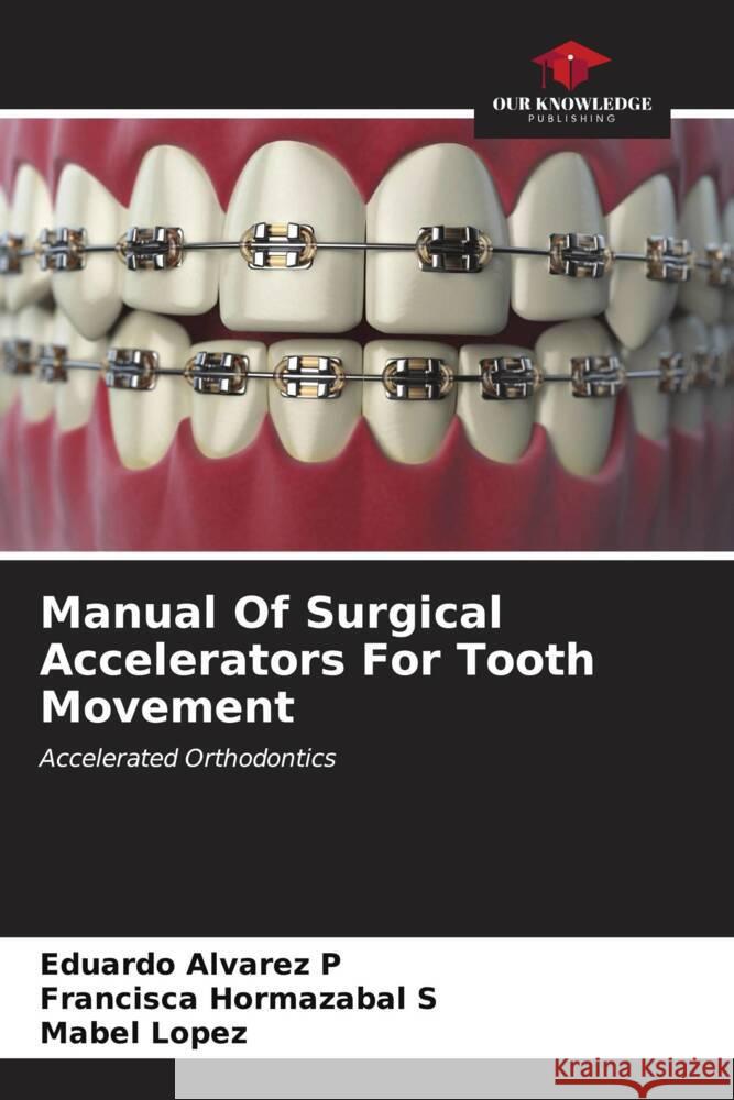 Manual Of Surgical Accelerators For Tooth Movement Alvarez P, Eduardo, Hormazabal S, Francisca, Lopez, Mabel 9786207086191