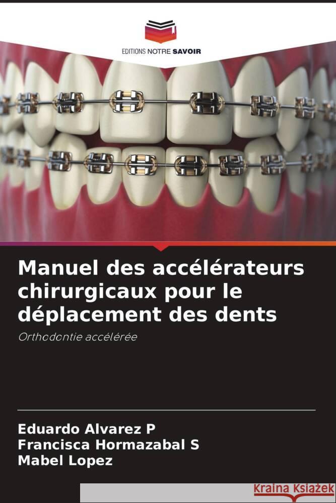 Manuel des accélérateurs chirurgicaux pour le déplacement des dents Alvarez P, Eduardo, Hormazabal S, Francisca, Lopez, Mabel 9786207086207