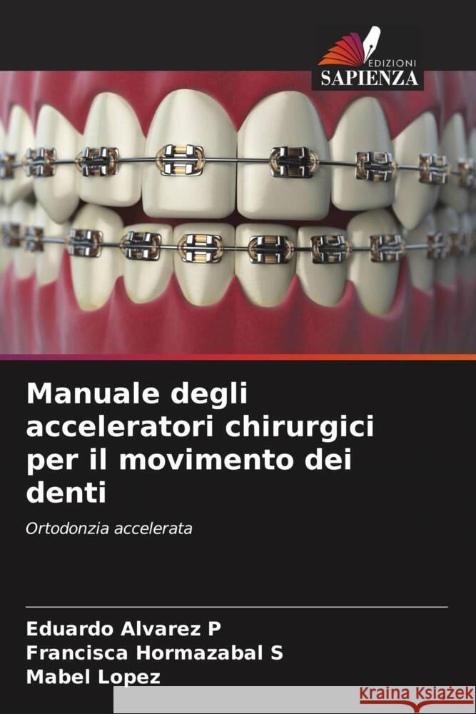 Manuale degli acceleratori chirurgici per il movimento dei denti Alvarez P, Eduardo, Hormazabal S, Francisca, Lopez, Mabel 9786207086221