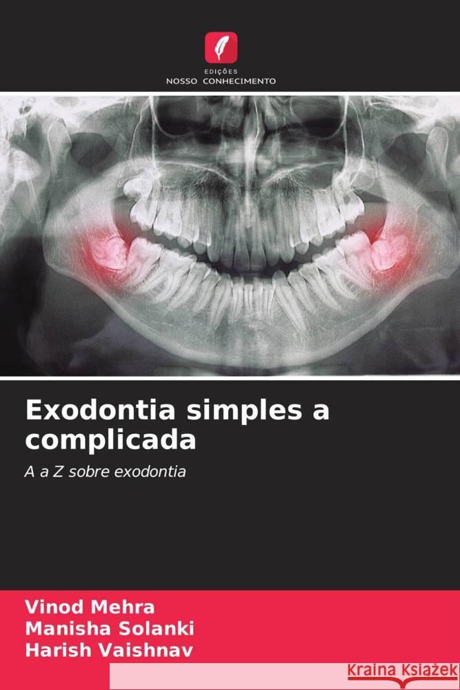 Exodontia simples a complicada Mehra, Vinod, Solanki, Manisha, VAISHNAV, HARISH 9786207091584