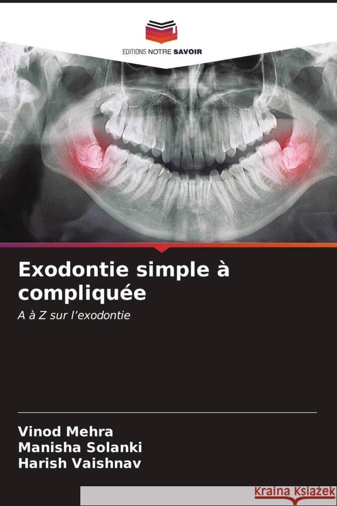 Exodontie simple à compliquée Mehra, Vinod, Solanki, Manisha, VAISHNAV, HARISH 9786207091607