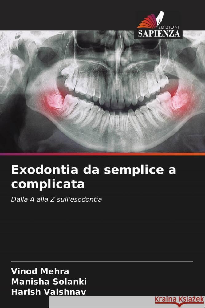 Exodontia da semplice a complicata Mehra, Vinod, Solanki, Manisha, VAISHNAV, HARISH 9786207091614