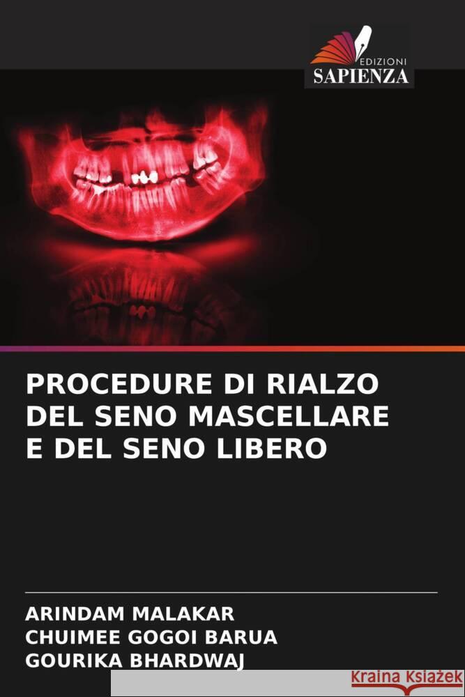 PROCEDURE DI RIALZO DEL SENO MASCELLARE E DEL SENO LIBERO Malakar, Arindam, Barua, Chuimee Gogoi, BHARDWAJ, GOURIKA 9786207095810 Edizioni Sapienza