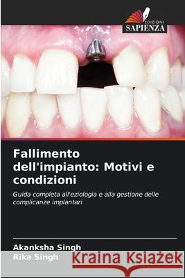 Fallimento dell'impianto: Motivi e condizioni Singh, Akanksha, Singh, Rika 9786207099832