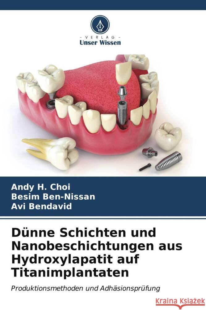 Dünne Schichten und Nanobeschichtungen aus Hydroxylapatit auf Titanimplantaten Choi, Andy H., Ben-Nissan, Besim, Bendavid, Avi 9786207100163