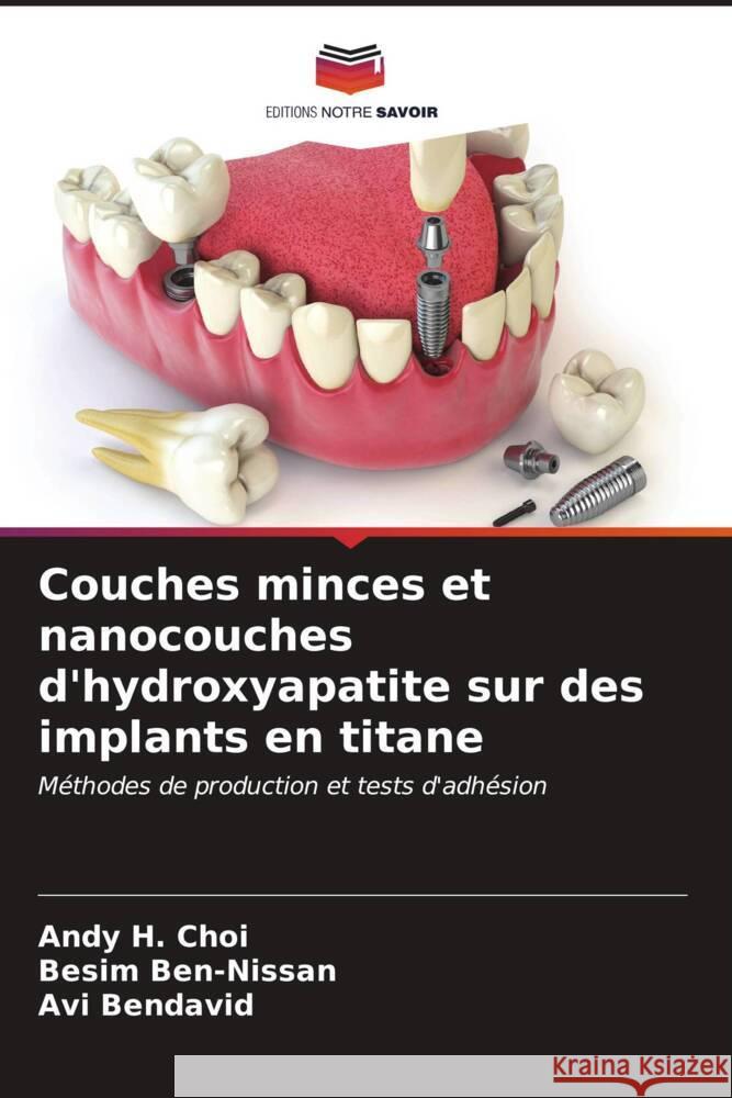 Couches minces et nanocouches d'hydroxyapatite sur des implants en titane Choi, Andy H., Ben-Nissan, Besim, Bendavid, Avi 9786207100187