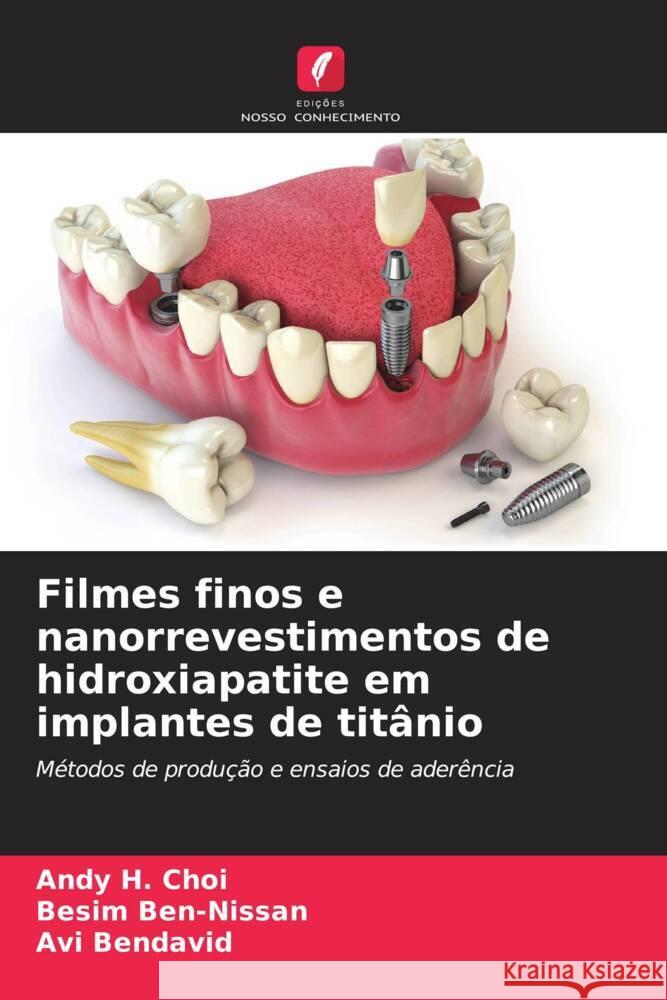 Filmes finos e nanorrevestimentos de hidroxiapatite em implantes de titânio Choi, Andy H., Ben-Nissan, Besim, Bendavid, Avi 9786207100200